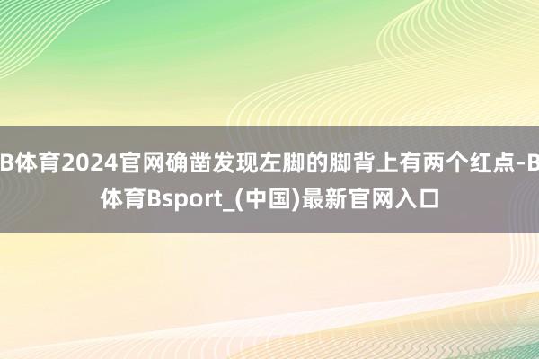 B体育2024官网确凿发现左脚的脚背上有两个红点-B体育Bsport_(中国)最新官网入口
